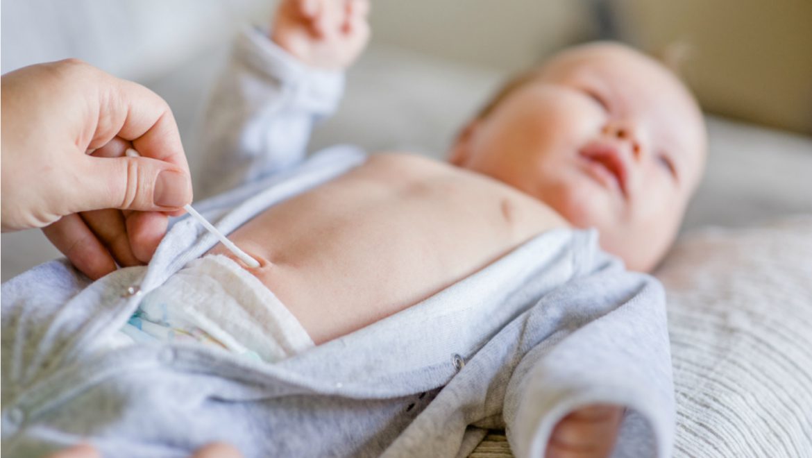 Dúvidas sobre o umbigo do bebê
