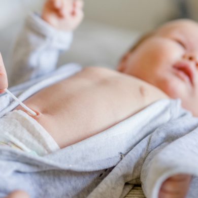 Dúvidas sobre o umbigo do bebê
