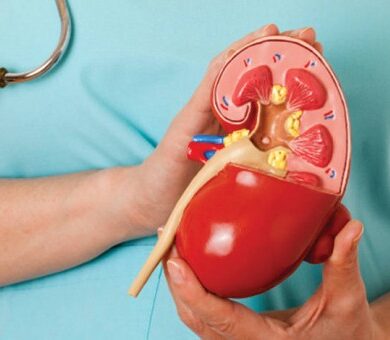 LITIASE RENAL – PEDRAS NOS RINS